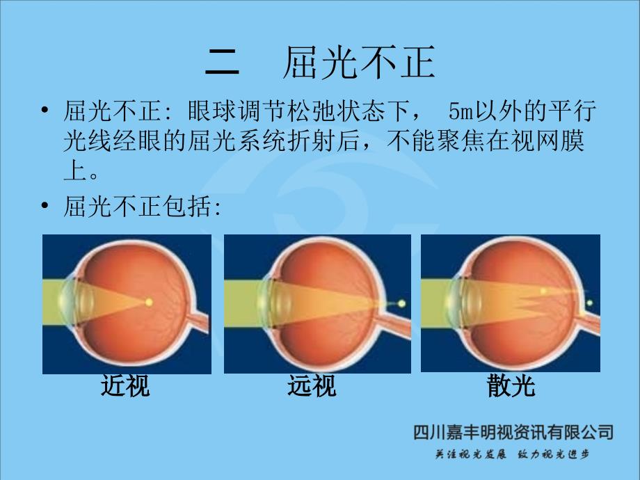 近视成因及危害课件_第4页