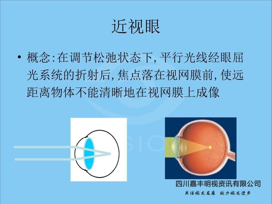 近视成因及危害课件_第5页