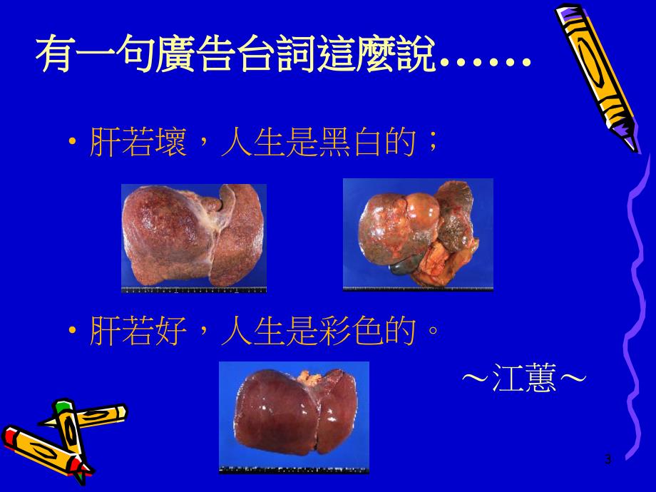 认识肝脏与肝炎防治.ppt_第3页