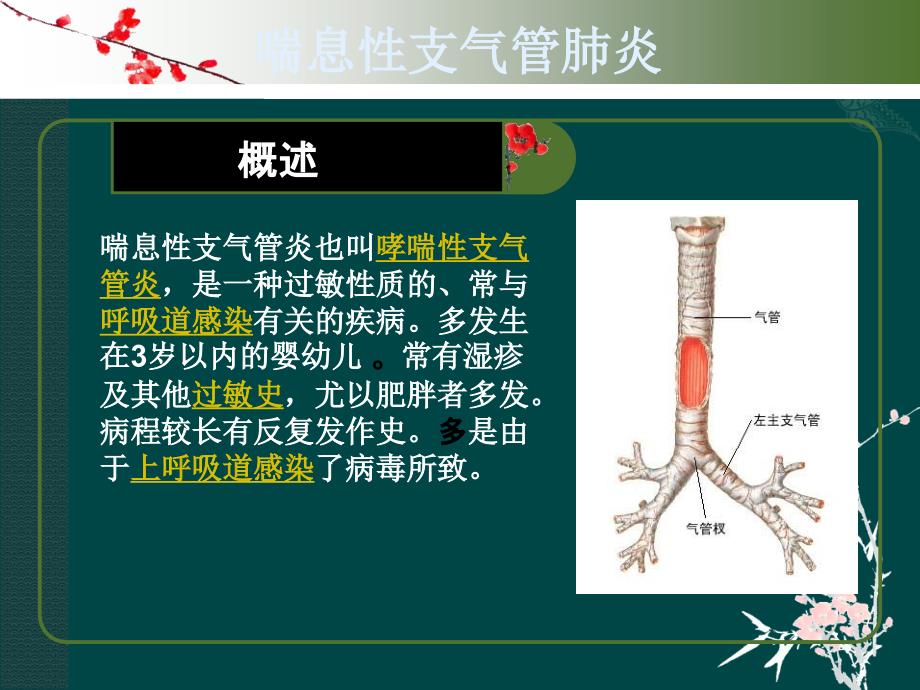 小儿支气管肺炎的护理PPT课件_第2页