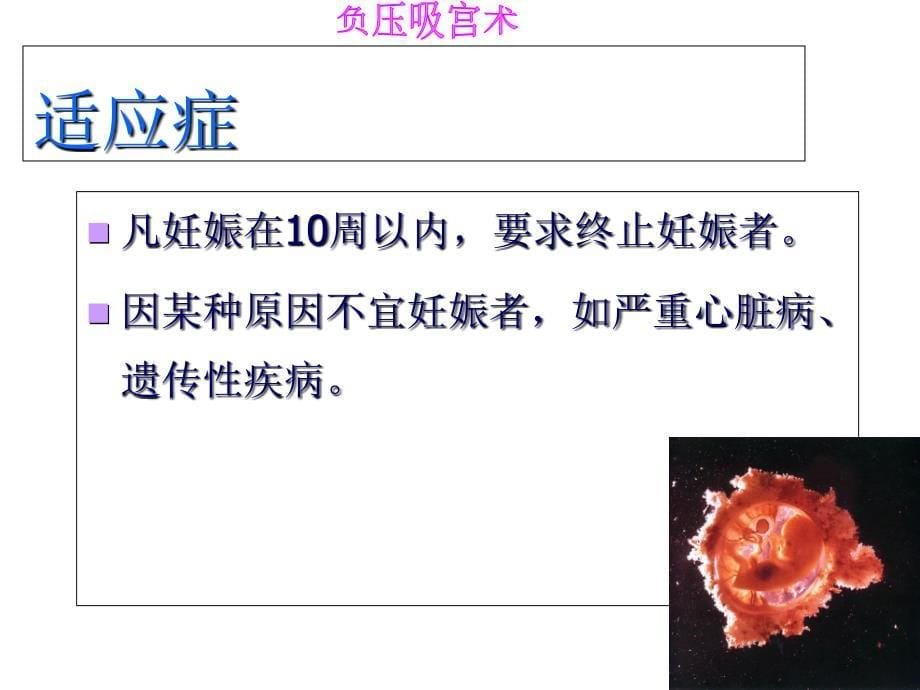 人工终止妊娠-妇产科学_第5页