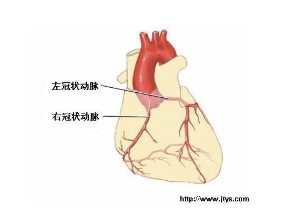 冠心病(课件)_第4页