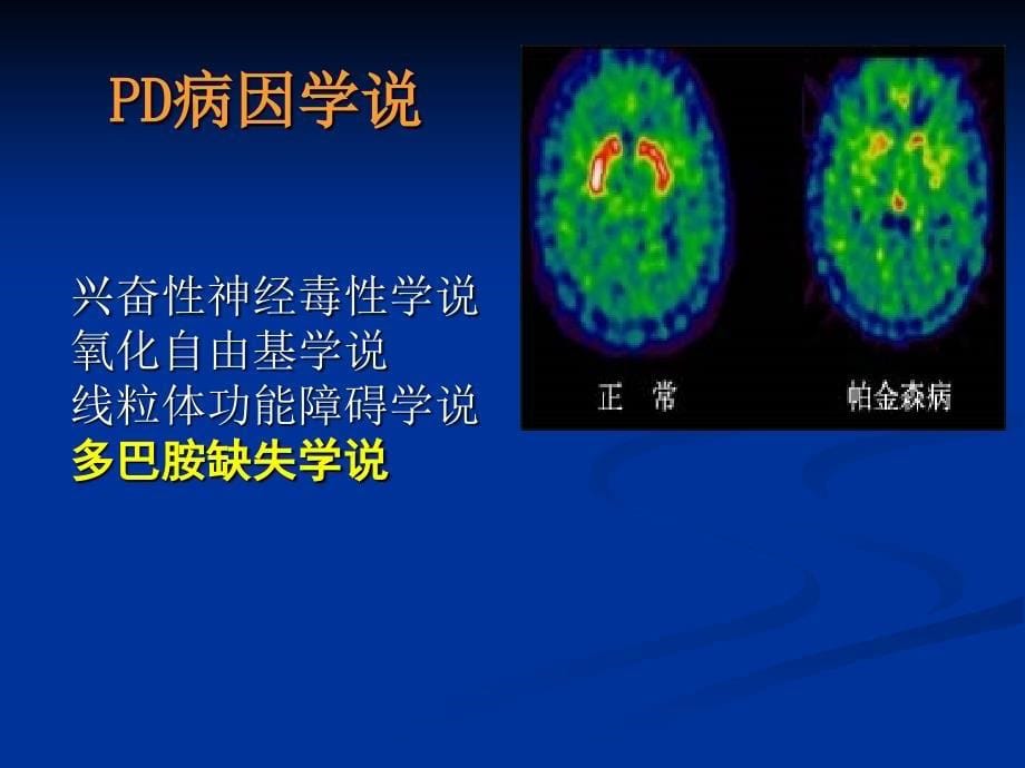 药理学抗帕金森病药ppt课件_第5页