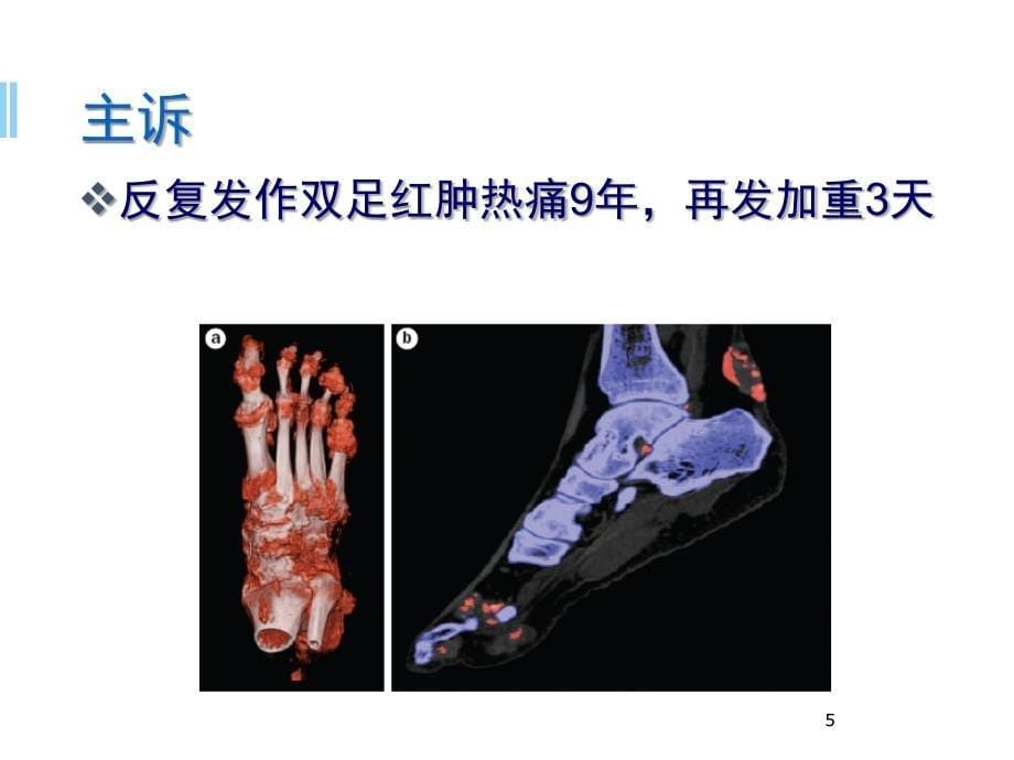 安康信病例分享ppt参考课件_第5页