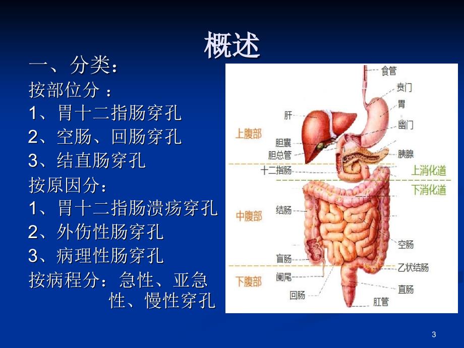 消化道穿孔资料ppt课件_第3页