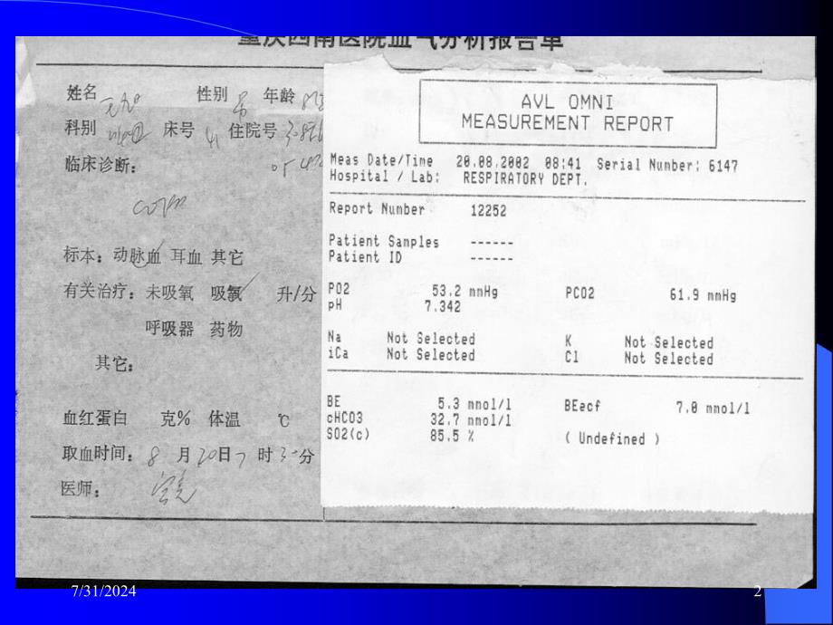 动脉血气分析及酸碱失衡的判断参考PPT_第2页