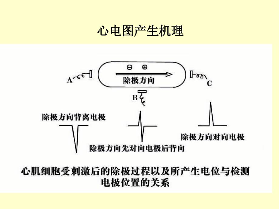 围术期常见的异常心电图分析_第2页