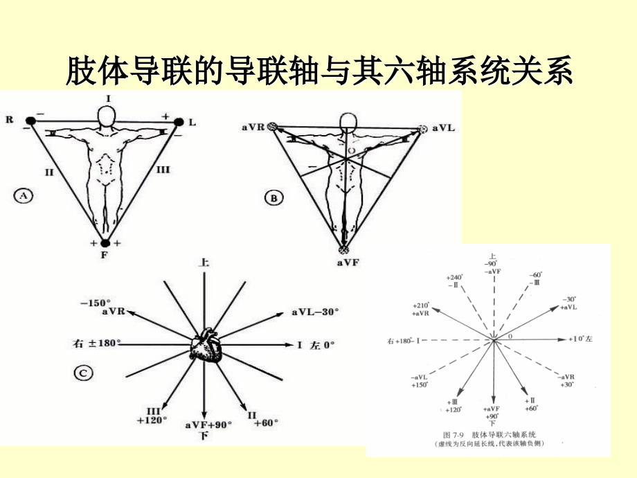 围术期常见的异常心电图分析_第3页