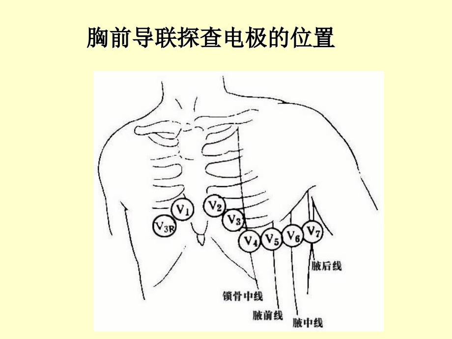 围术期常见的异常心电图分析_第4页