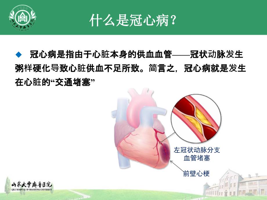 PCI术后健康教育_第4页