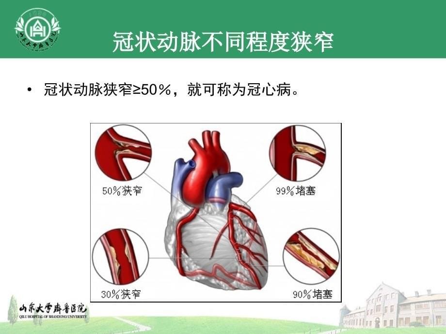 PCI术后健康教育_第5页