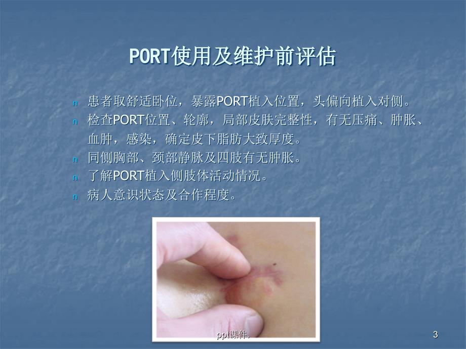 PORT使用及维护和常见问题ppt课件_第3页