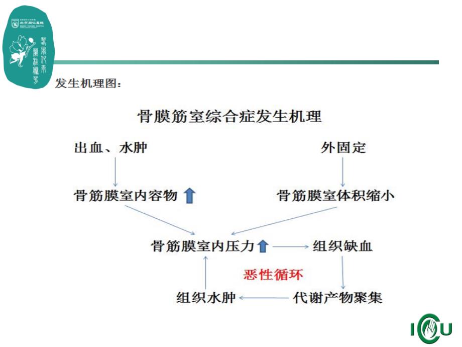 骨筋膜室呢综合症ppt课件_第4页