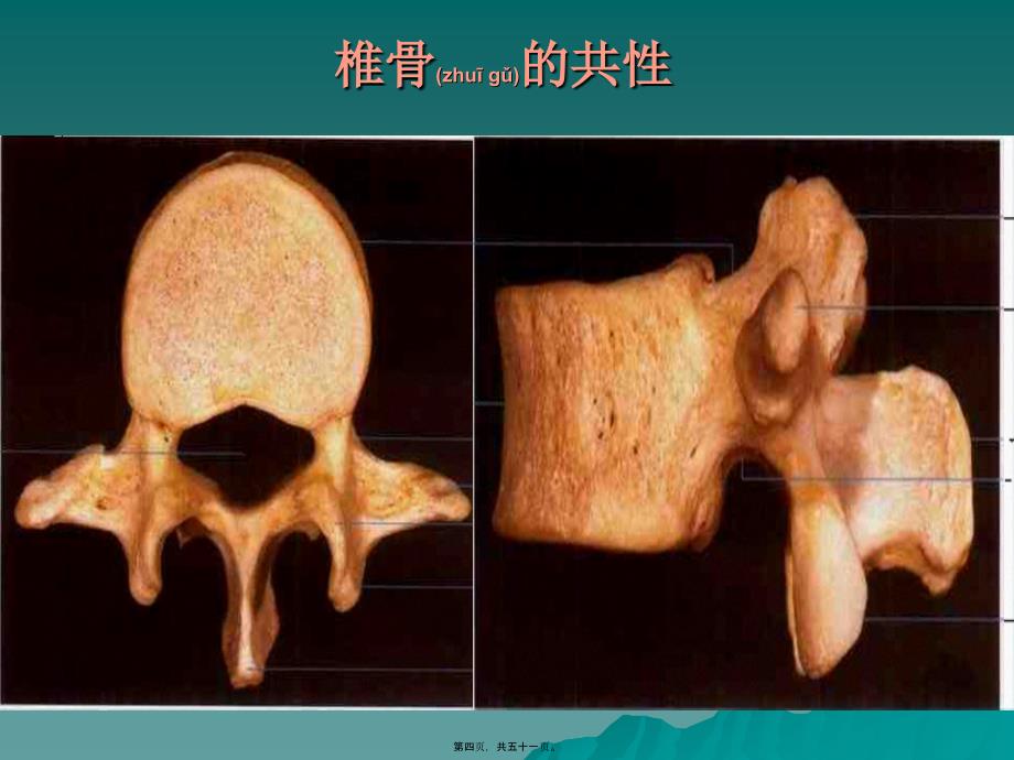 医学专题—急性脊髓损伤13553_第4页