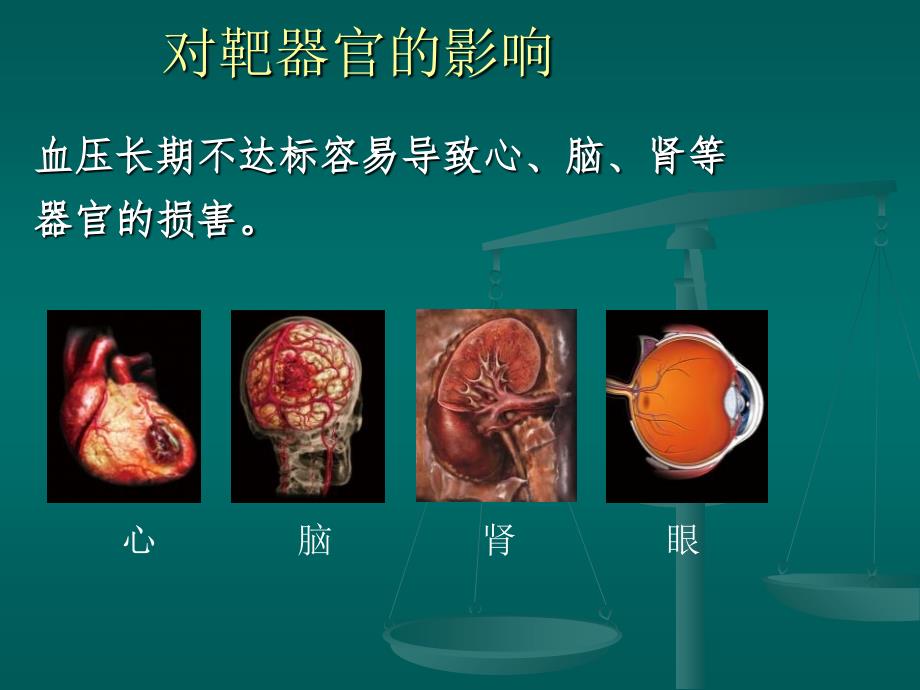 社区高血压综合管理的主要内容和措施讲解_第4页