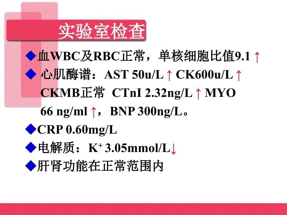 优质课件急性重症心肌炎病例讨论_第5页