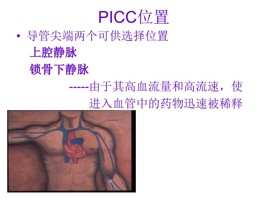 PICC置管术相关知识_第4页