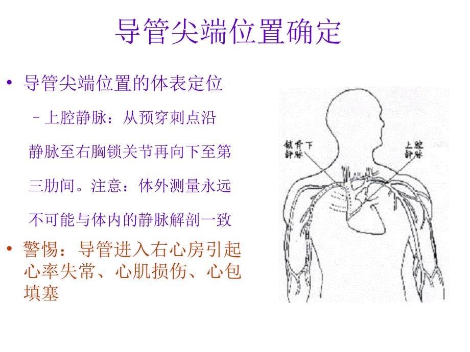 PICC置管术相关知识_第5页