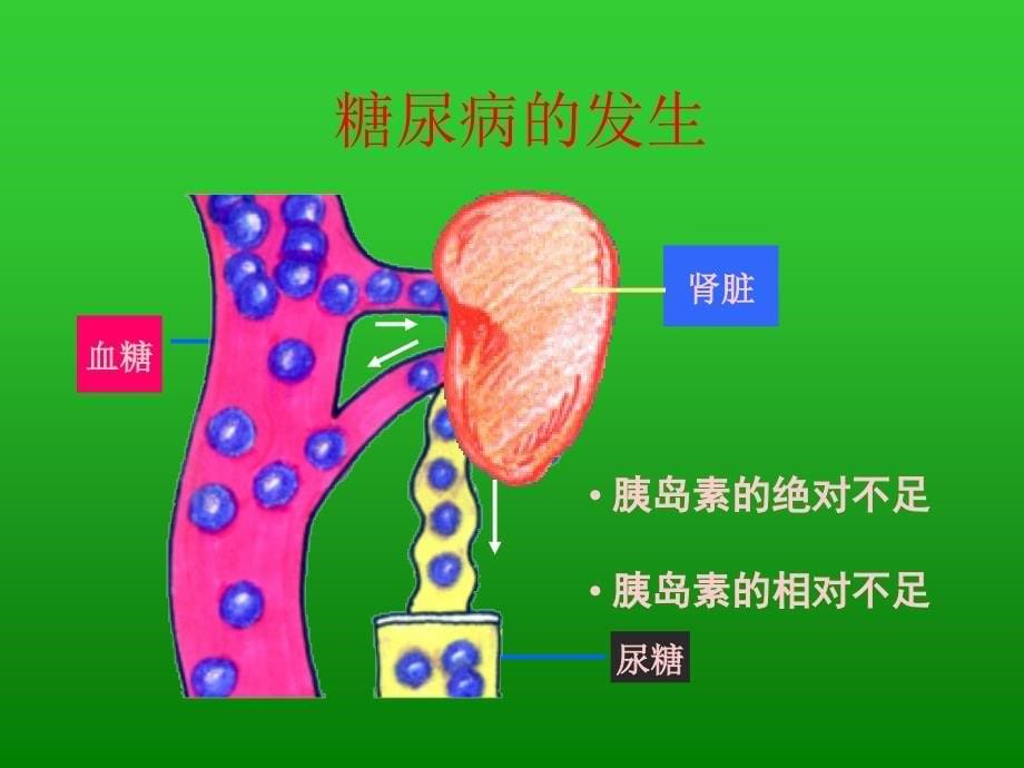 糖尿病的饮食治疗_第5页