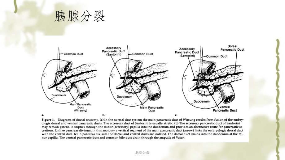 胰腺分裂ppt课件_第3页