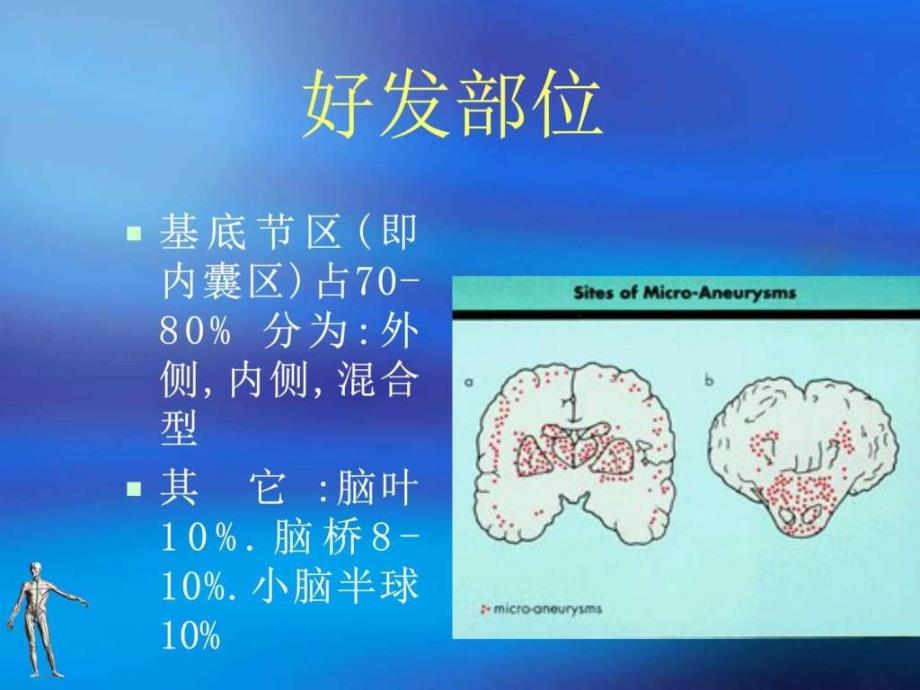 6脑出血图文.ppt16_第4页