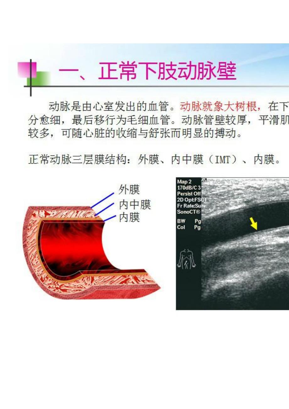 下肢血管彩超_第2页