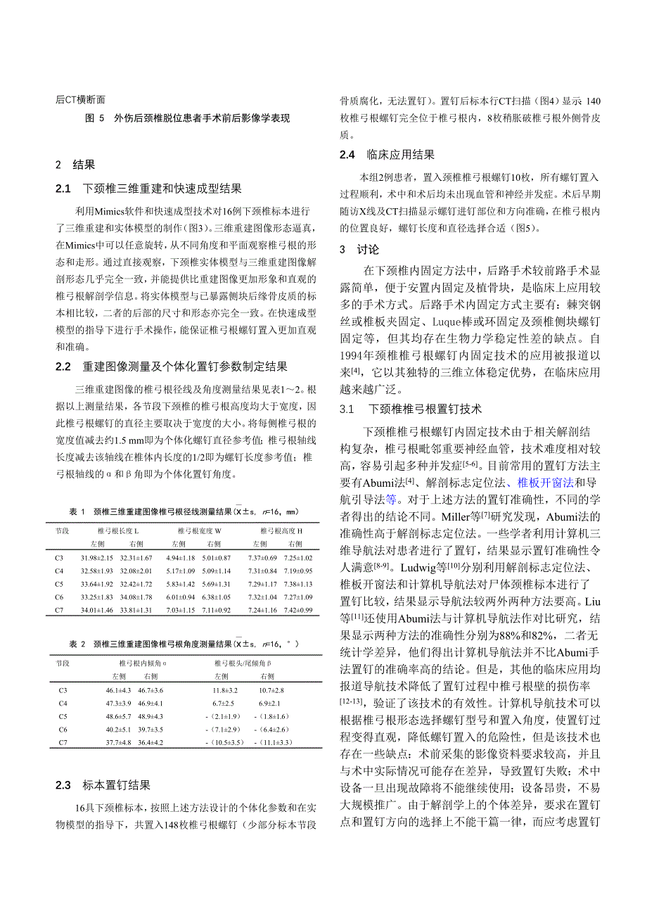 Mimics及脊柱模型用于下颈椎椎弓根个体化置钉的应用研究_第4页