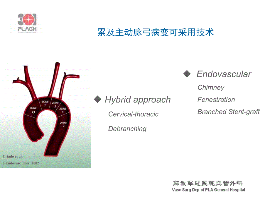 主动脉弓复杂病变_第2页