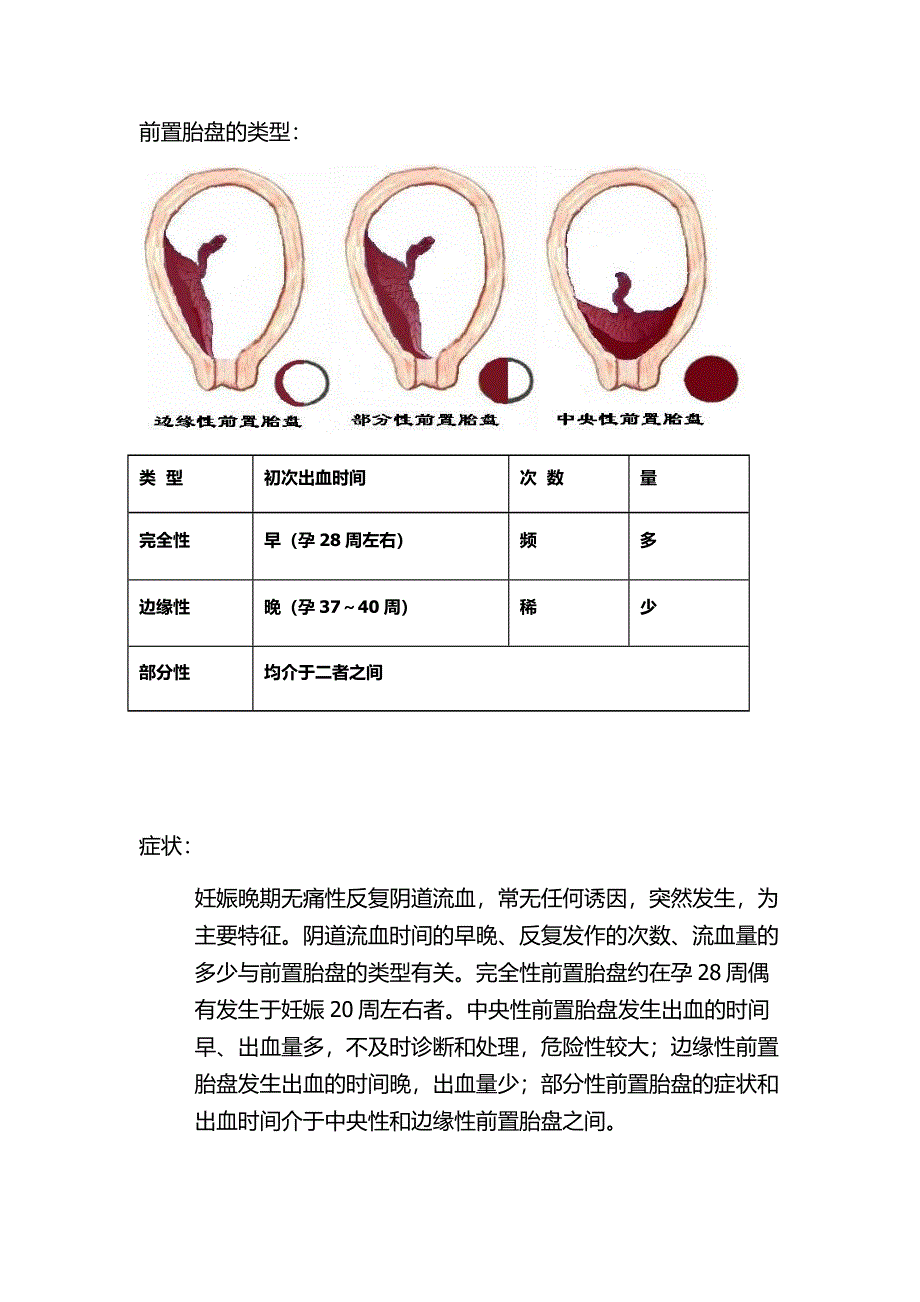 前置胎盘的护理查房.docx_第2页