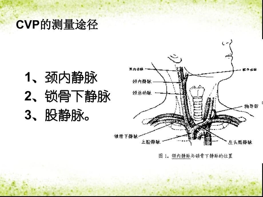 小讲课——中心静脉压的测量及临床意义_第5页