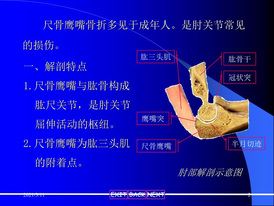 imz尺骨鹰嘴骨折_第2页