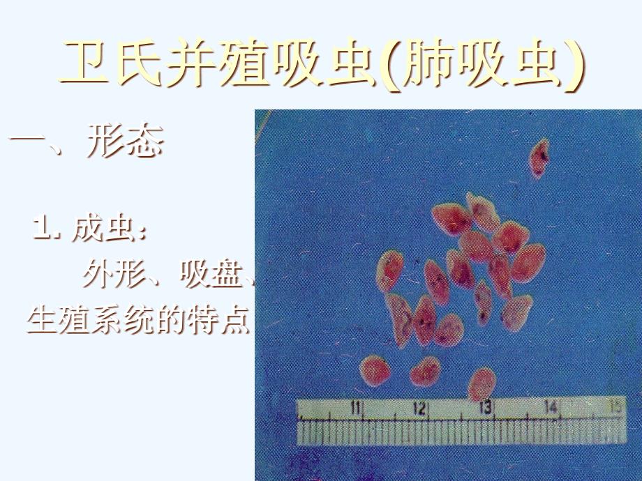 卫氏并殖吸虫(肺吸虫)_第2页