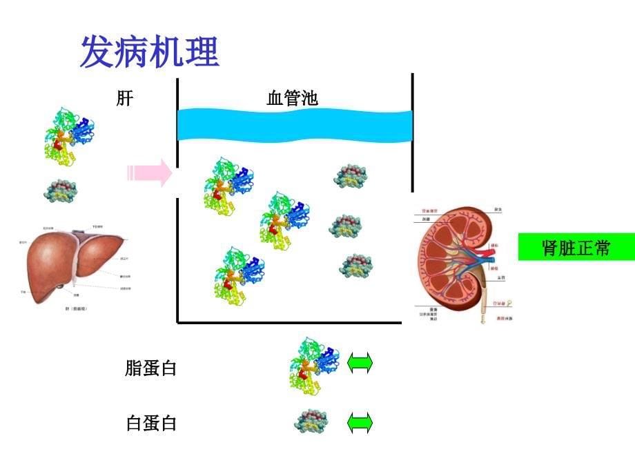 《儿科学》肾病综合征-PPT精品文档_第5页