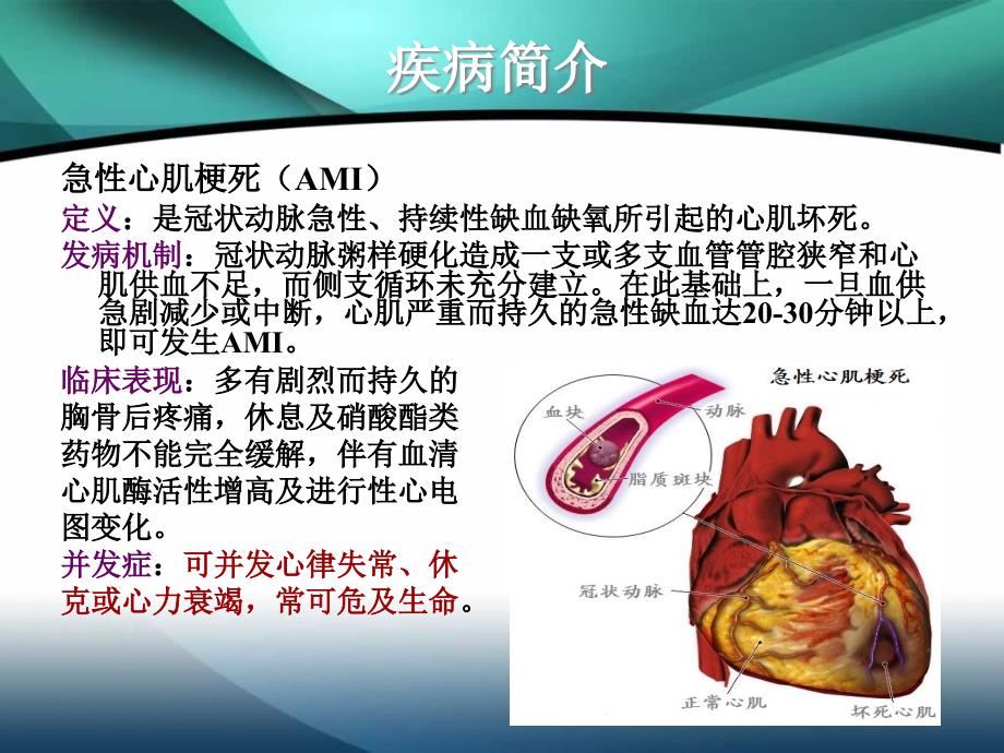 一例急性心肌梗死患者的病例分析课件_第3页