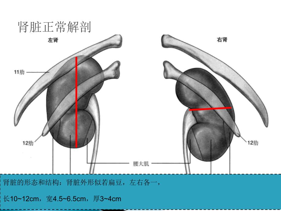 肾脏常见疾病.ppt_第4页