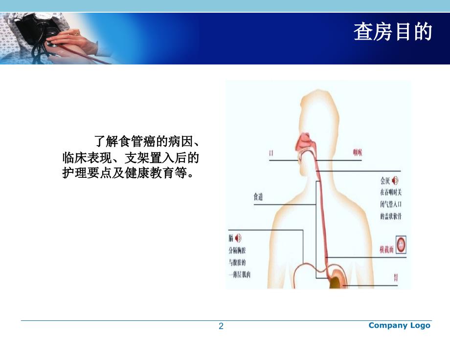 食管癌支架置入护理查房1课件_第2页