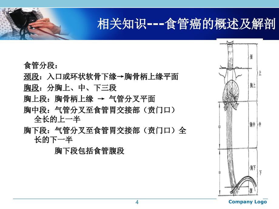 食管癌支架置入护理查房1课件_第4页