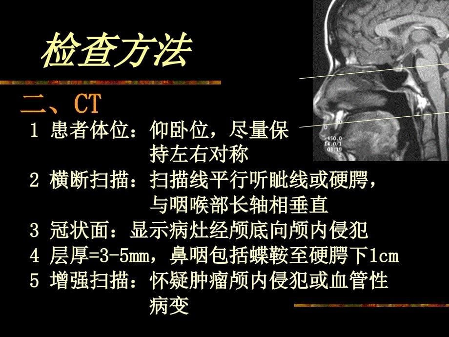 鼻咽及喉部影像学诊断_第5页