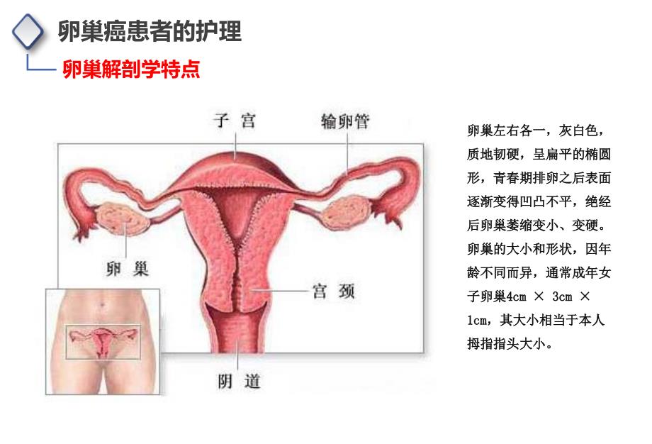 卵巢癌患者的护理_第2页