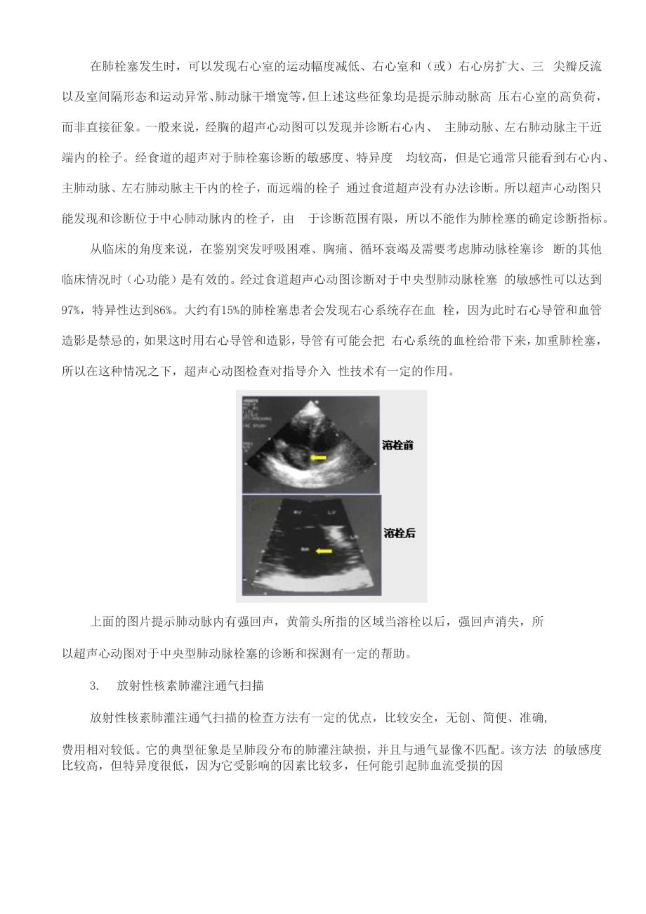 肺动脉栓塞的影像学诊断_第3页