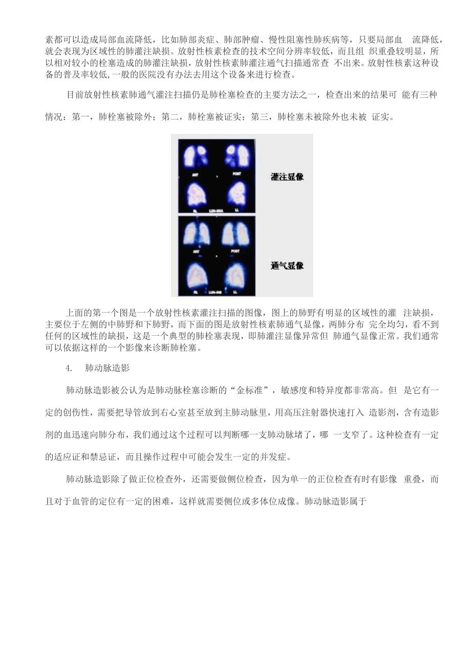 肺动脉栓塞的影像学诊断_第4页