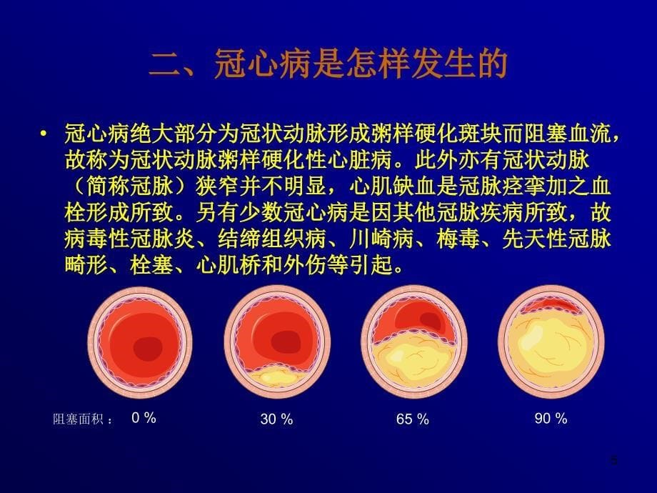 怎样战胜冠心病_第5页