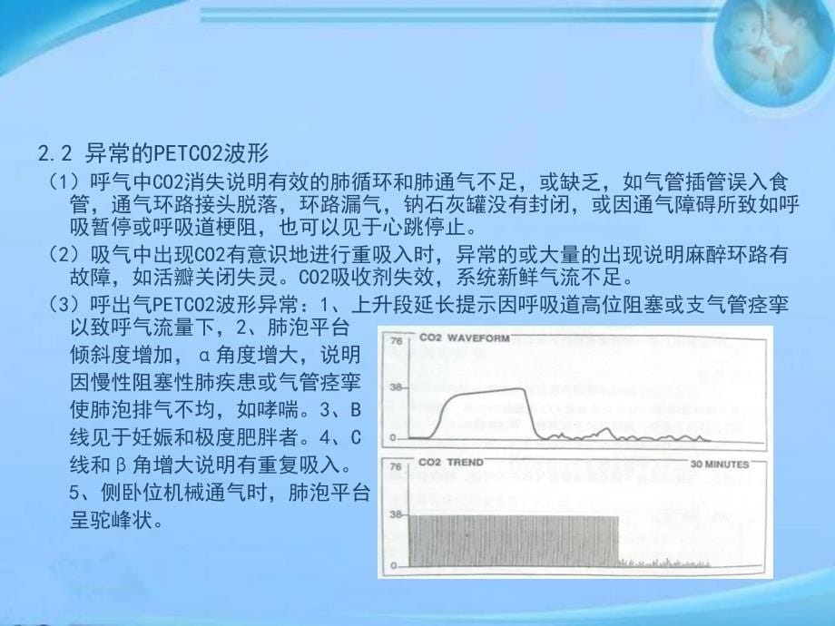 ICU护理技术呼吸末二氧化碳监测ppt课件_第5页