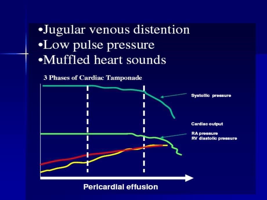 心包压塞的早期表现和处理_第5页