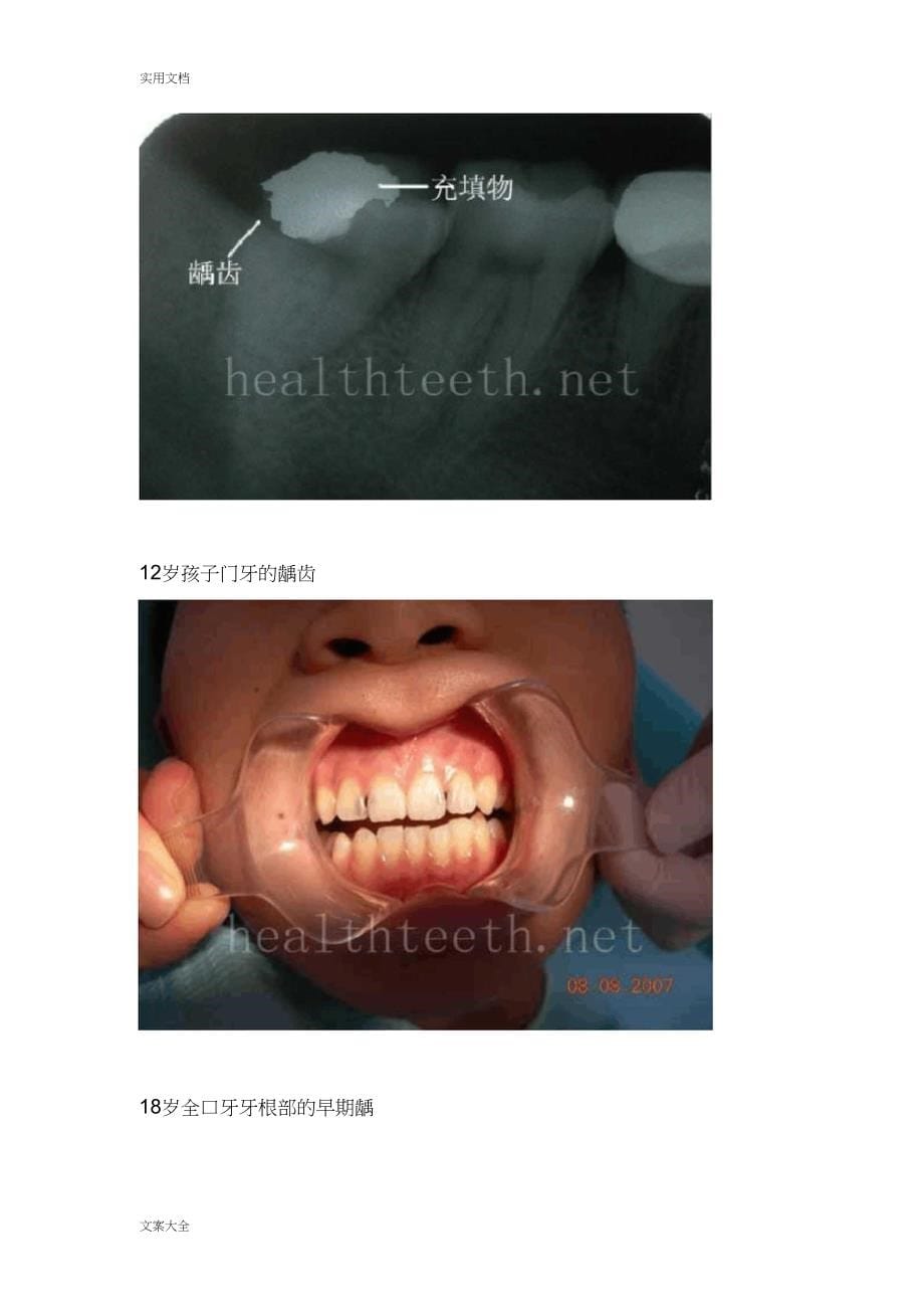 口腔常见疾病图片展_第5页