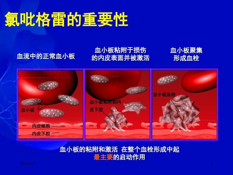 氯吡格雷抵抗PPT课件_第2页