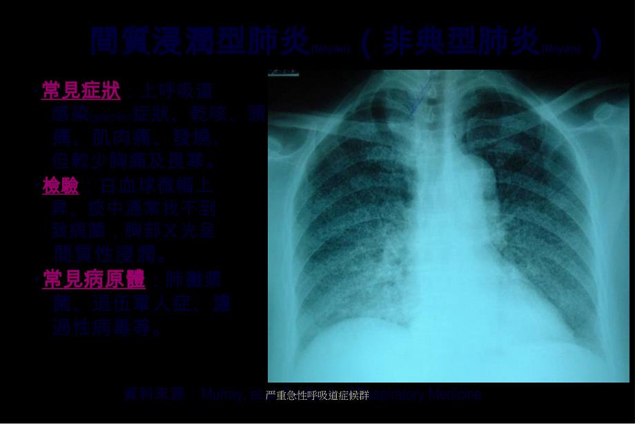 严重急性呼吸道症候群课件_第3页