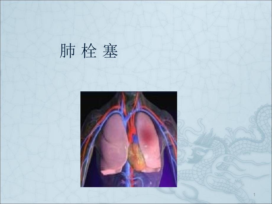 肺栓塞课件ppt演示课件_第1页