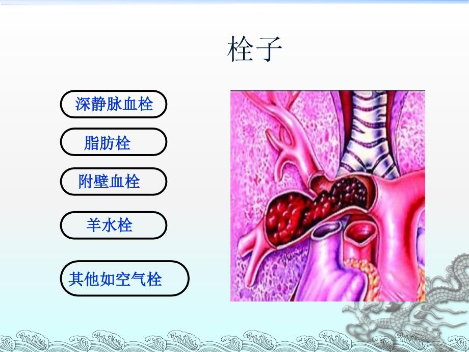 肺栓塞课件ppt演示课件_第3页