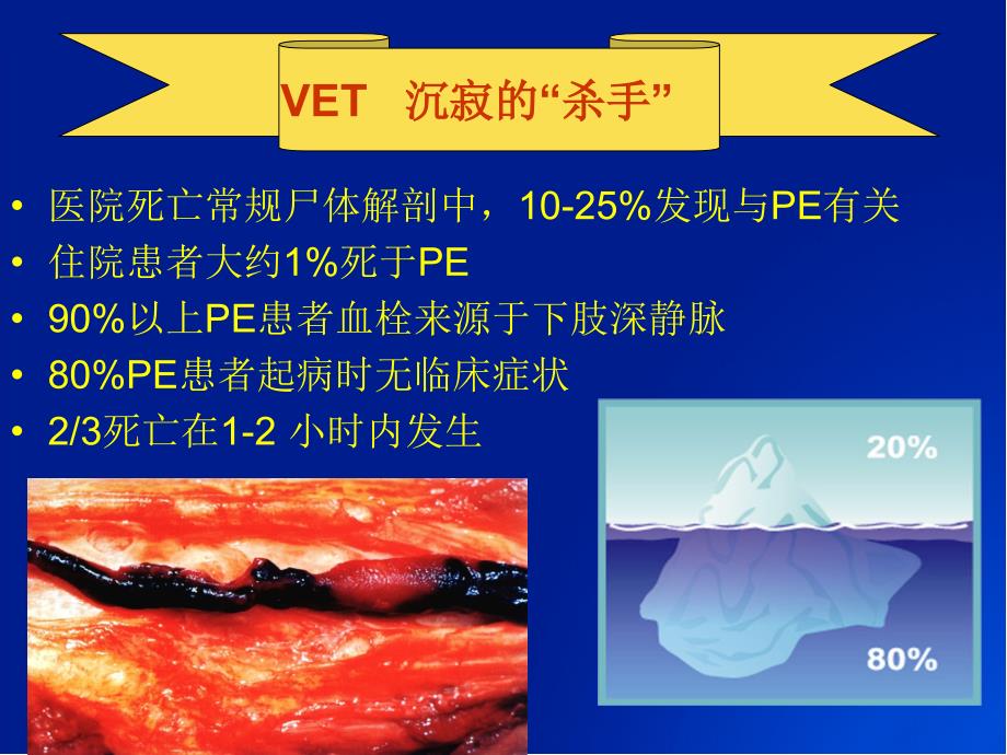 VTE预防的护理管理[一].ppt_第3页